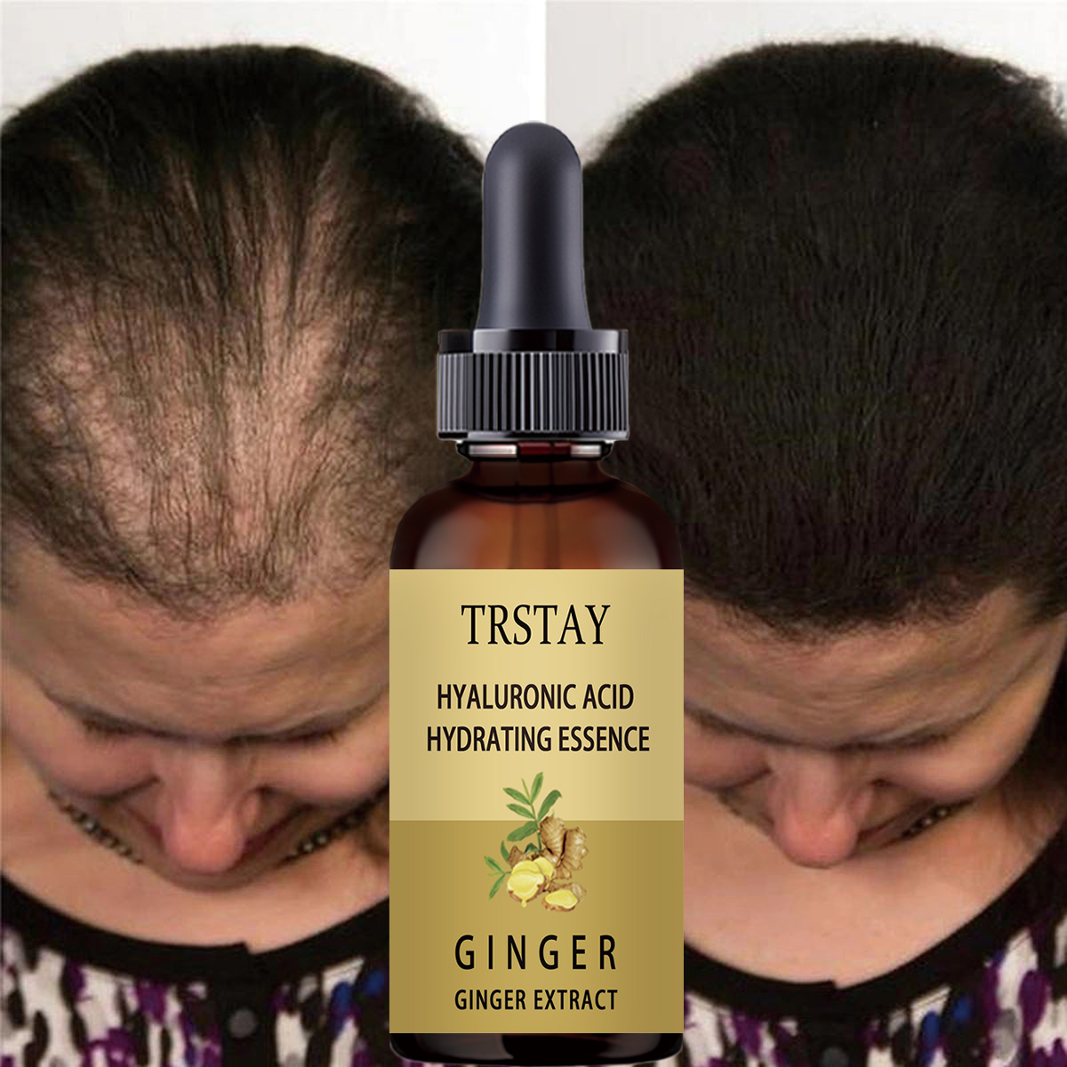 Serum Anti pencegah rambut ron - Hair Care Gisou ulasan dan harga